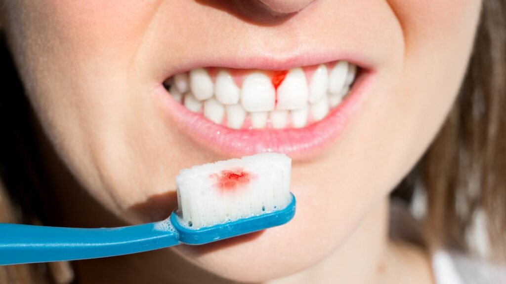 tooth brush blood